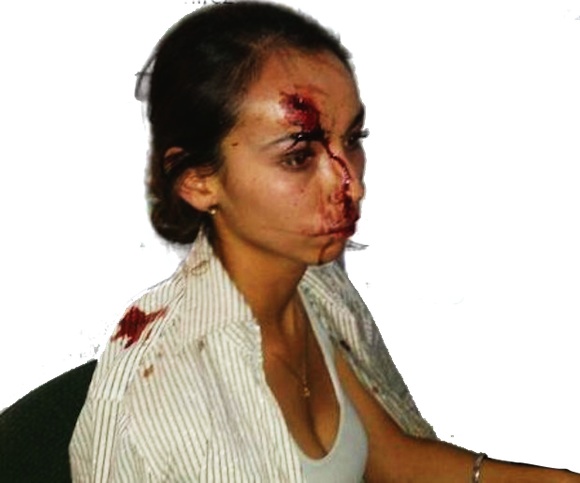 Agresión cobarde a la periodista guanajuatense Karla Janeth Silva.